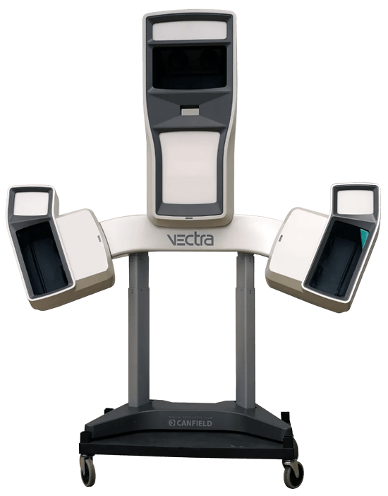 Icon representing Vectra 3D, a nose imaging technology for surgical planning.