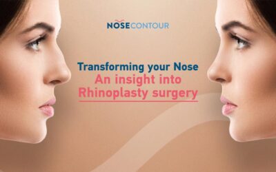Transforming your Nose – An insight into Rhinoplasty Surgery